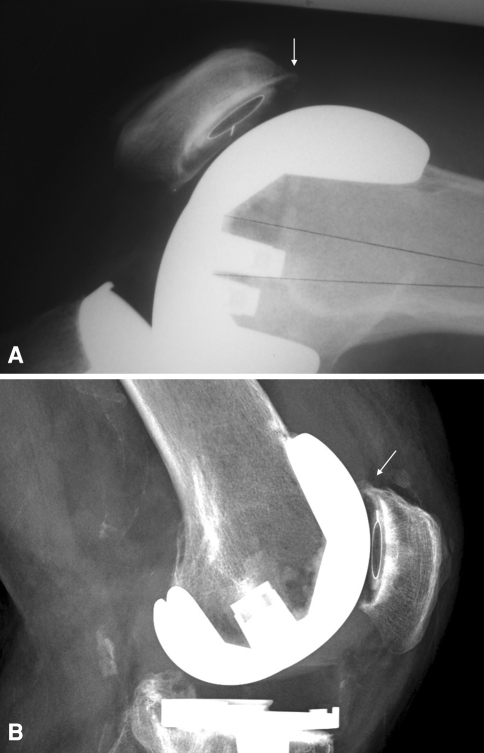 Fig. 5A–B