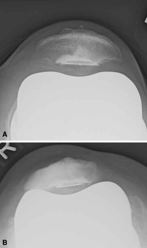 Fig. 6A–B