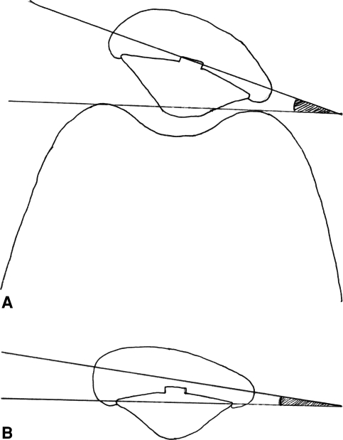 Fig. 4A–B