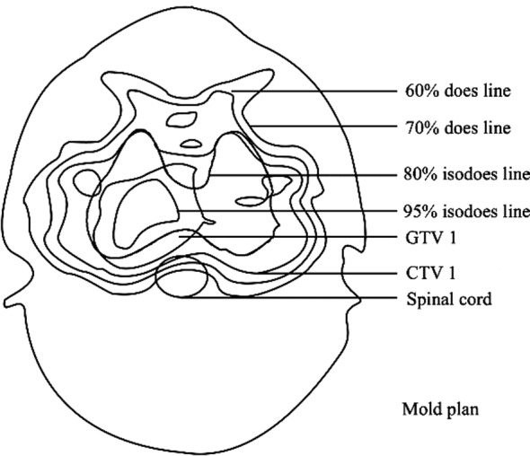 Fig.2