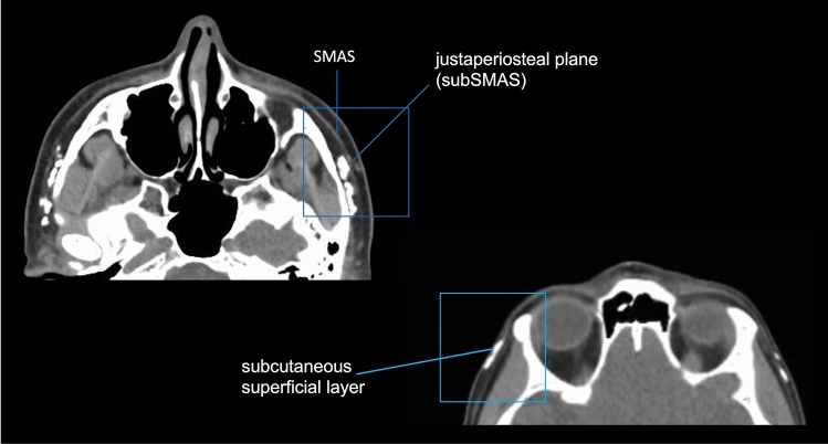 Fig. 10