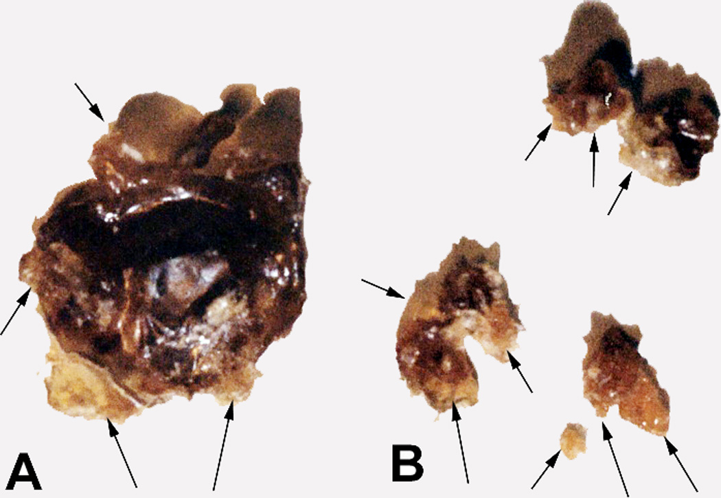 Fig. 18