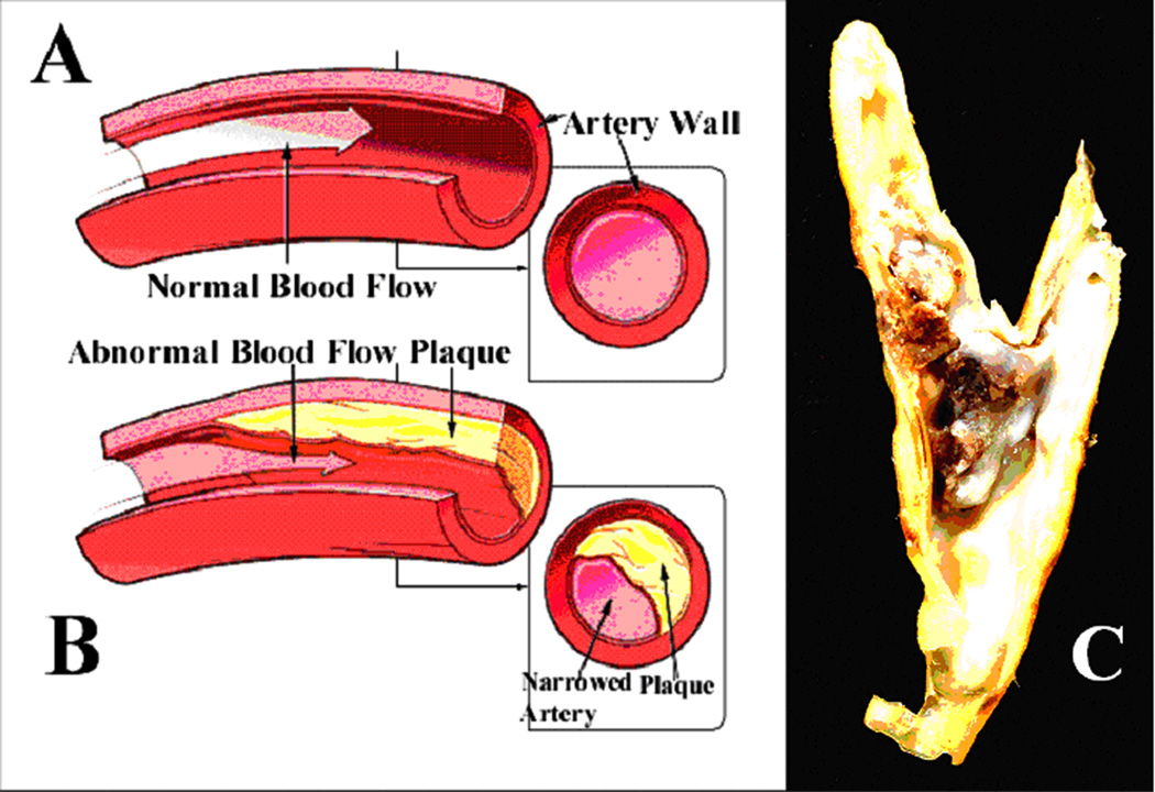 Fig. 1