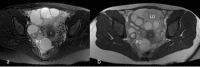 Fig 5