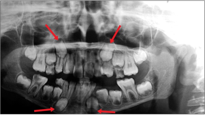 Fig. 3