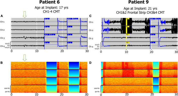 FIGURE 4