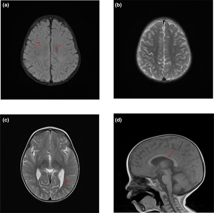 FIGURE 2