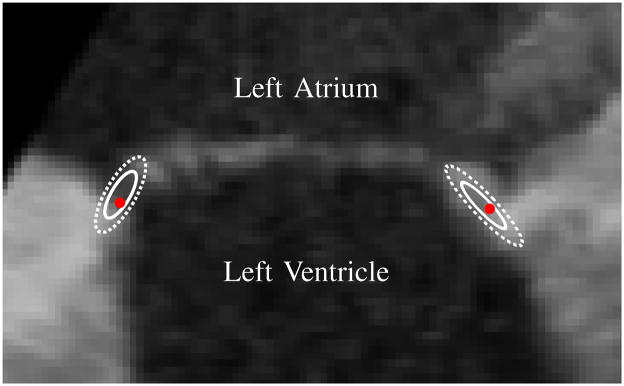 Fig. 15