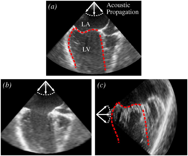 Fig. 14