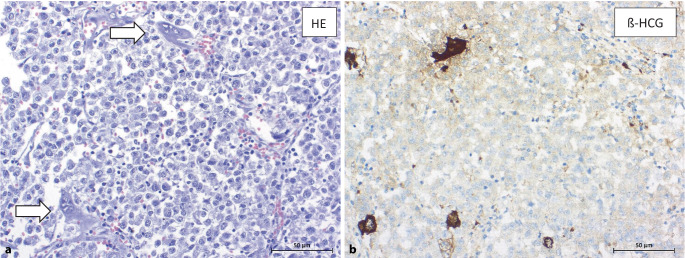 graphic file with name 292_2022_1113_Fig1_HTML.jpg