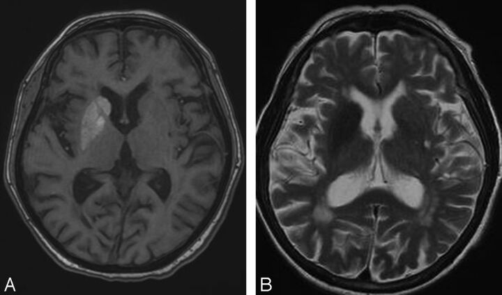 Fig 3.