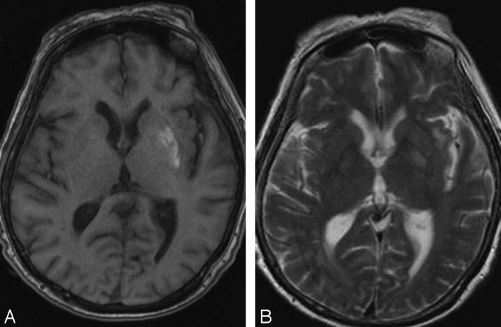 Fig 2.