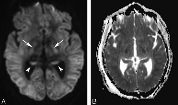 Fig 6.