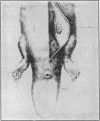 115