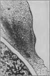 102