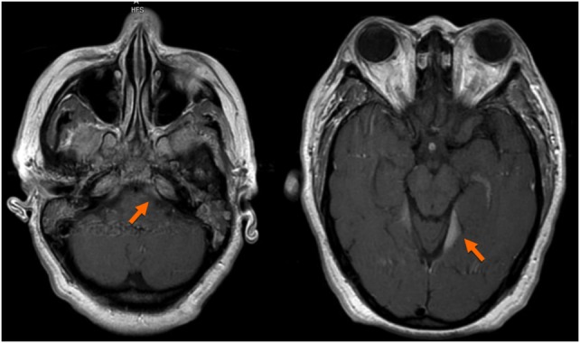 Figure 4