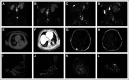 FIG 2.