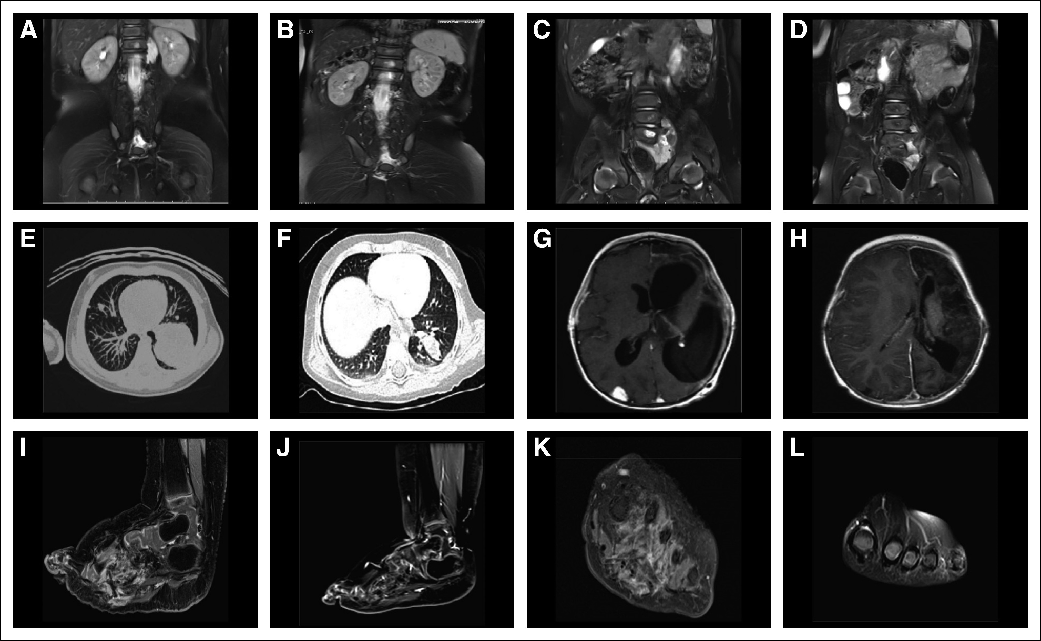 FIG 2.