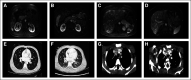 FIG 1.