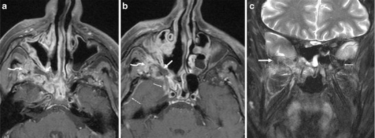 Fig. 8