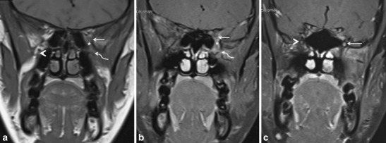 Fig. 10