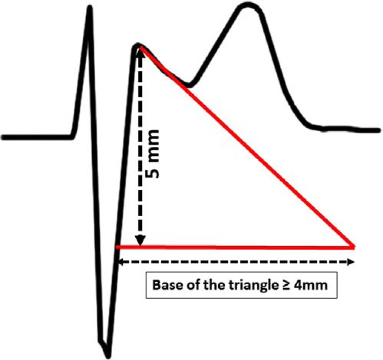 Fig. (4)