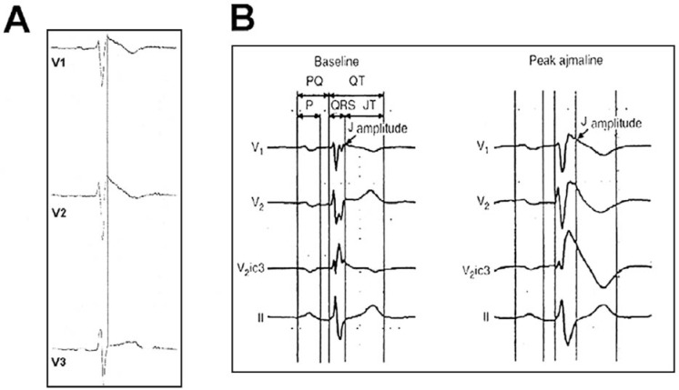 Fig. (2)