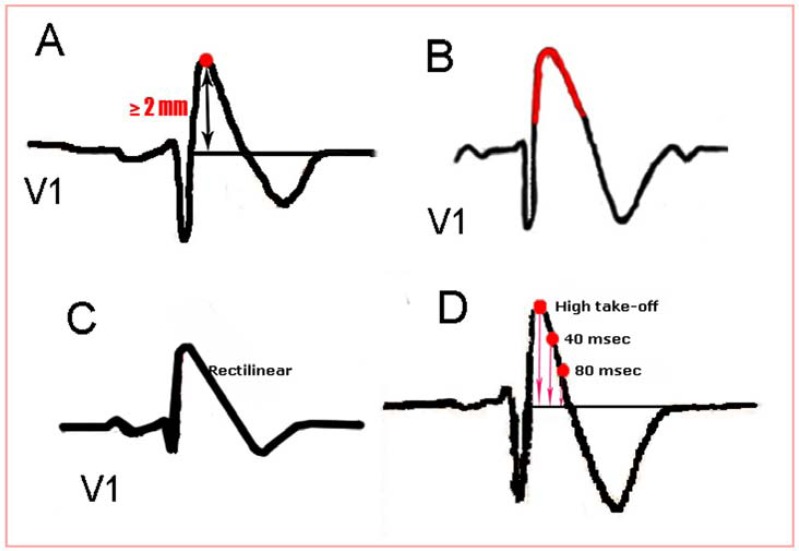 Fig. (1)