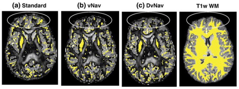 Fig. 11