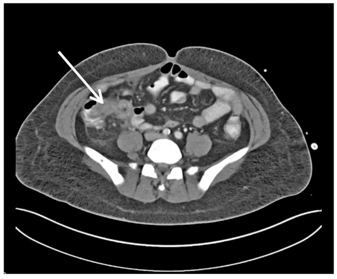 Figure 1 -