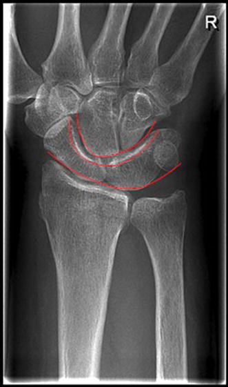 Fig. 7