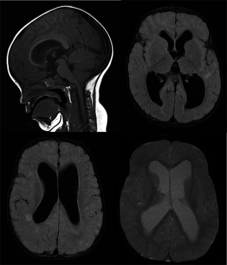 Fig. 1