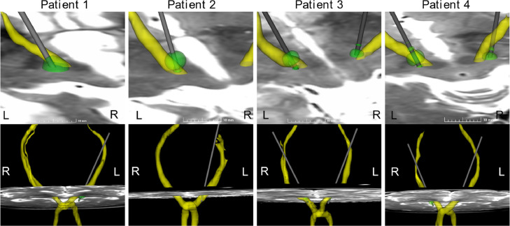 Fig 4