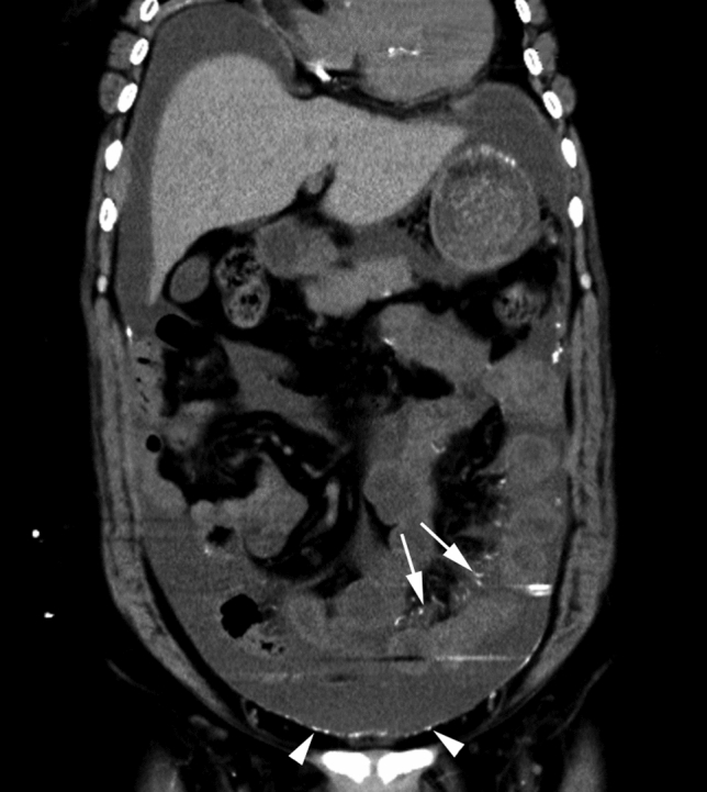 Fig. 5