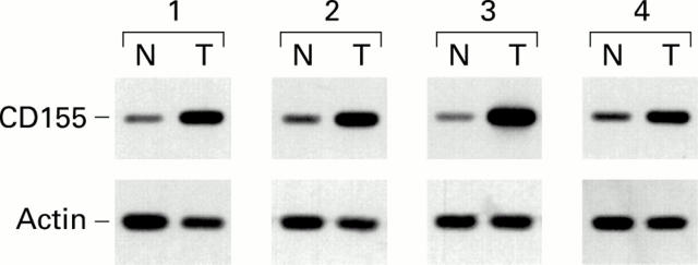 Figure 2  