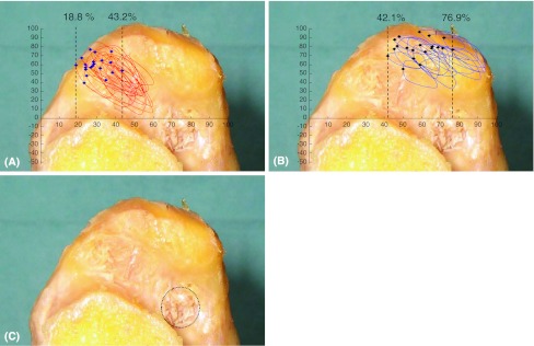 Fig. 4A–C