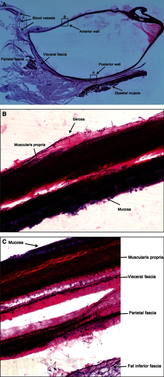 Fig. 13