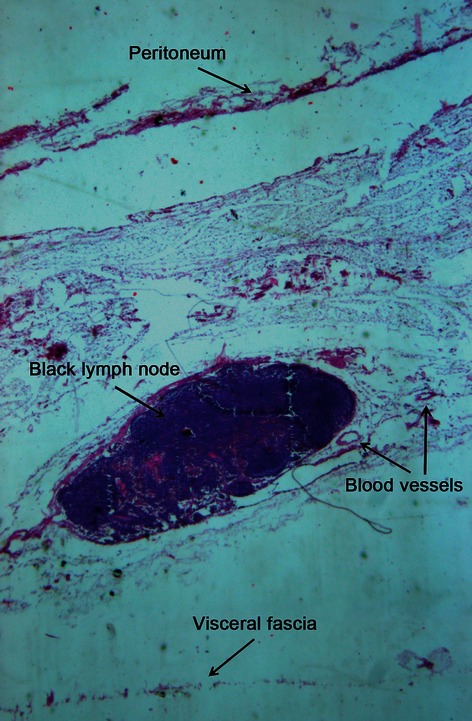 Fig. 11