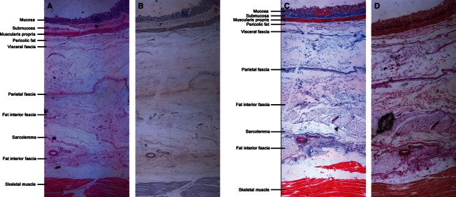 Fig. 14