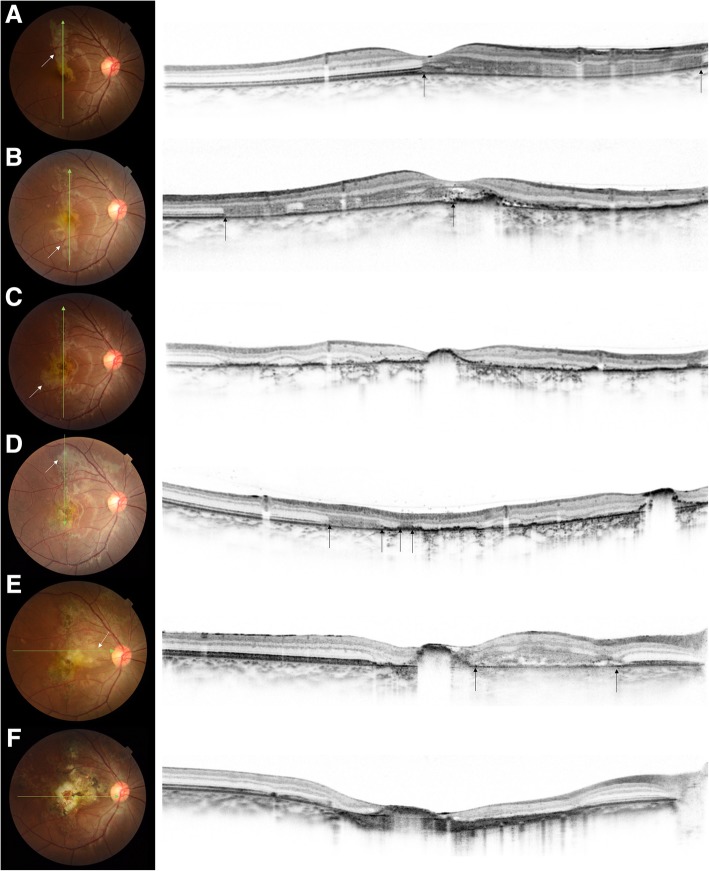 Fig. 3