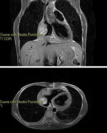 Fig. 1