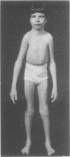 474