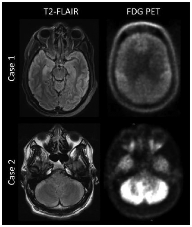 Figure 2: