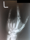 Figure 3: