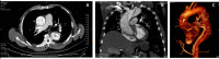 Fig. 1A to C