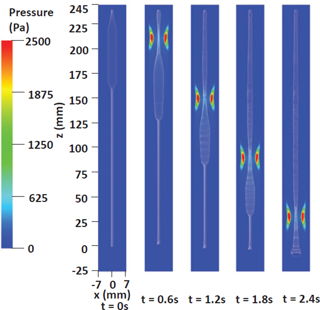 Fig. 12