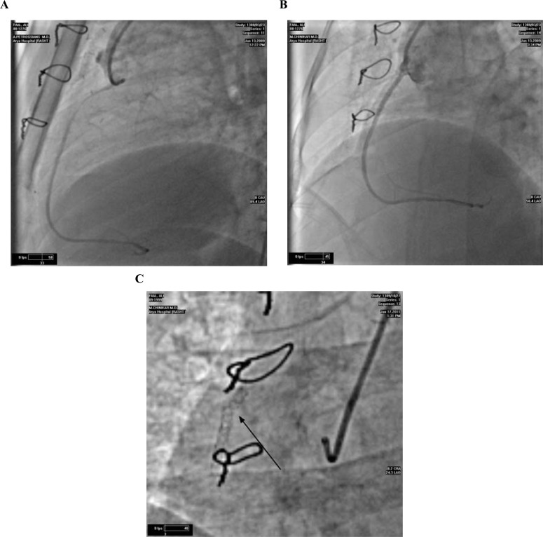 Fig. (1)