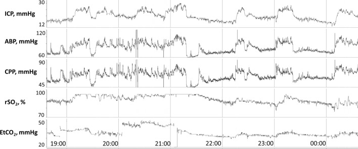 Fig. 2