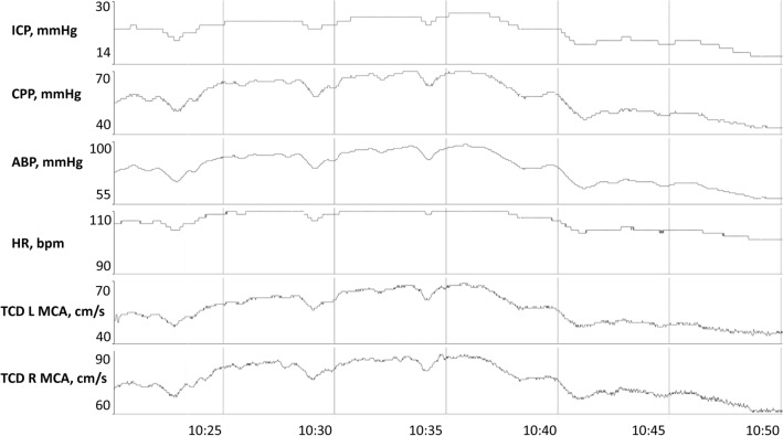 Fig. 4