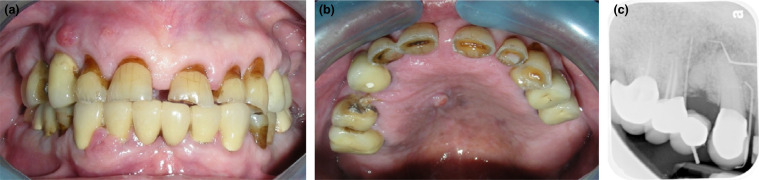 Figure 12